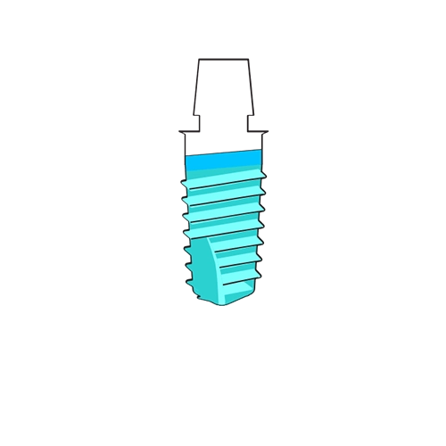 Dental screw illustration