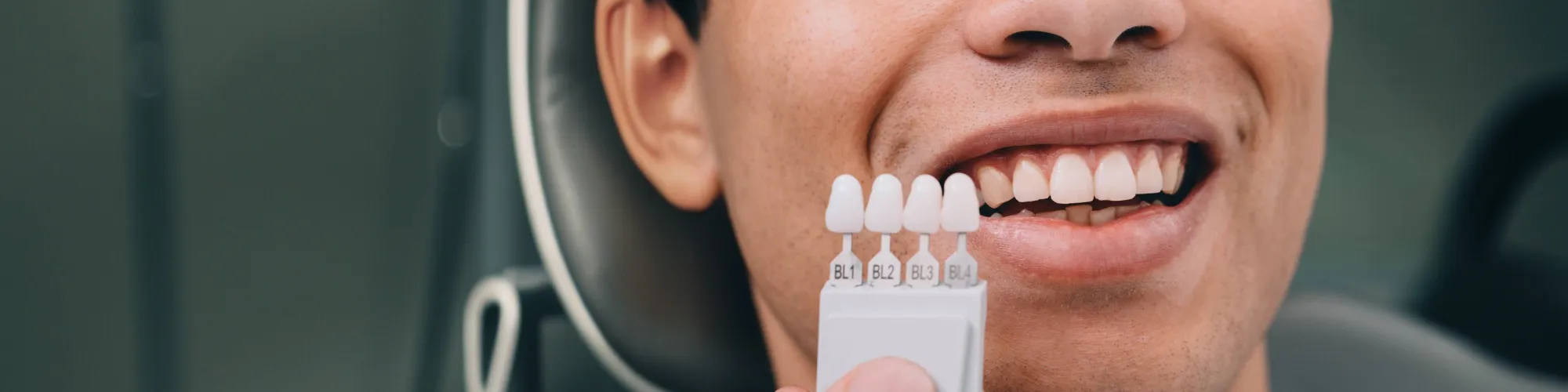 Hand holding tooth shade-matching tool against man's smile.